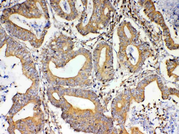 TSPAN12 Rabbit Polyclonal Antibody