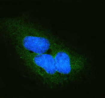 DYNLT1 Rabbit Polyclonal Antibody