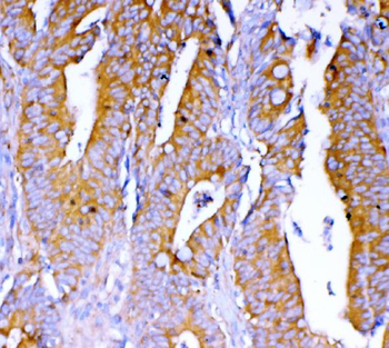 DYNLT1 Rabbit Polyclonal Antibody