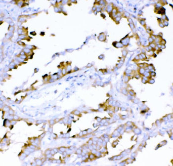 DYNLT1 Rabbit Polyclonal Antibody