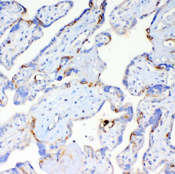 DYNLT1 Rabbit Polyclonal Antibody