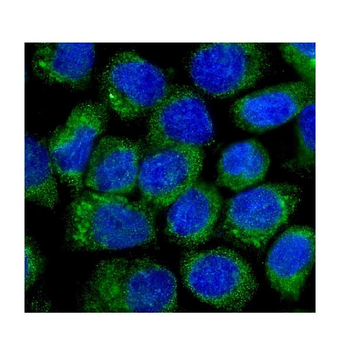 NOV/CCN3 Rabbit Polyclonal Antibody