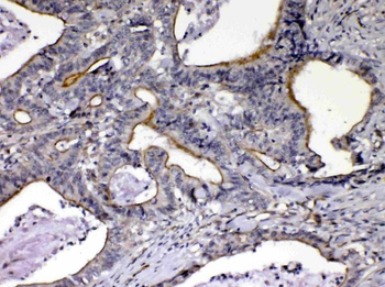 NOV/CCN3 Rabbit Polyclonal Antibody