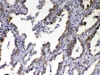 NOV/CCN3 Rabbit Polyclonal Antibody