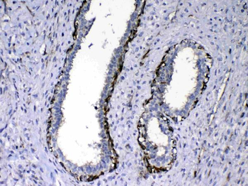 NOV/CCN3 Rabbit Polyclonal Antibody