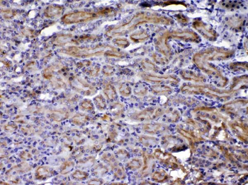 NOV/CCN3 Rabbit Polyclonal Antibody