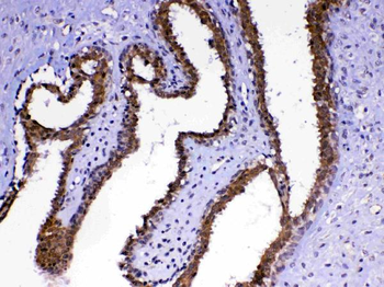 MED4 Rabbit Polyclonal Antibody