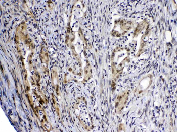 MED4 Rabbit Polyclonal Antibody