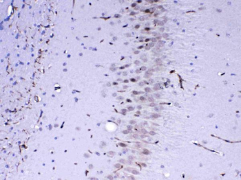 MED4 Rabbit Polyclonal Antibody