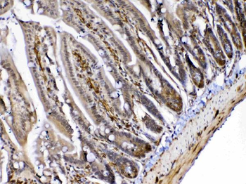 MED4 Rabbit Polyclonal Antibody