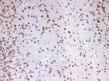 MED4 Rabbit Polyclonal Antibody