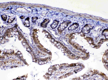 MED4 Rabbit Polyclonal Antibody