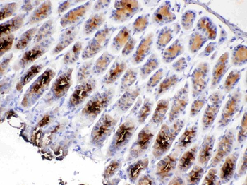 TFF2 Rabbit Polyclonal Antibody