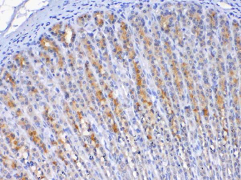 TFF2 Rabbit Polyclonal Antibody
