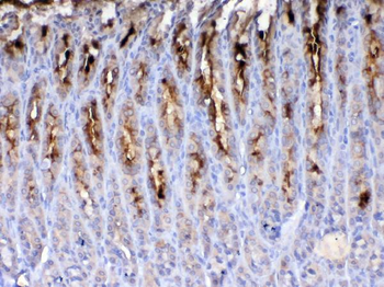 TFF2 Rabbit Polyclonal Antibody