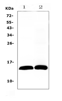 TFF2 Rabbit Polyclonal Antibody