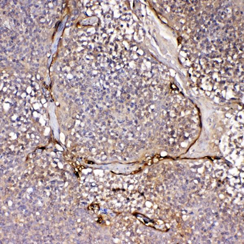 IL1F10 Rabbit Polyclonal Antibody