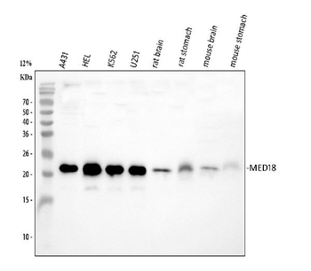 MED18 Rabbit Polyclonal Antibody