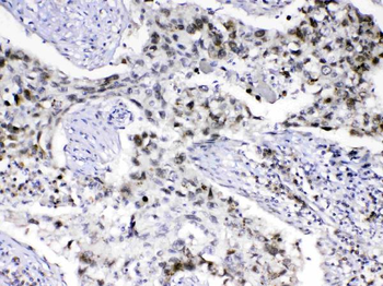 MED18 Rabbit Polyclonal Antibody