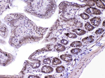 MED18 Rabbit Polyclonal Antibody