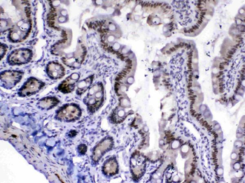 MED18 Rabbit Polyclonal Antibody