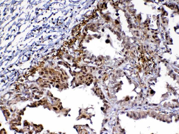MED9 Rabbit Polyclonal Antibody