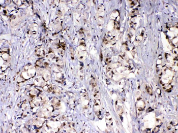 MED9 Rabbit Polyclonal Antibody