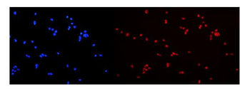 hnRNP A2B1/HNRNPA2B1 Rabbit Polyclonal Antibody