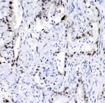 hnRNP A2B1/HNRNPA2B1 Rabbit Polyclonal Antibody