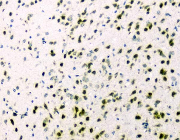 hnRNP A2B1/HNRNPA2B1 Rabbit Polyclonal Antibody