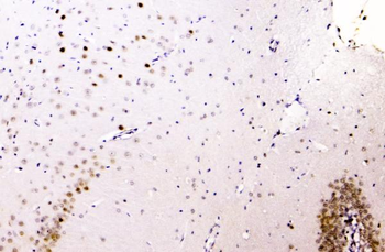 hnRNP A2B1/HNRNPA2B1 Rabbit Polyclonal Antibody