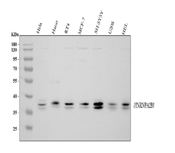 hnRNP A2B1/HNRNPA2B1 Rabbit Polyclonal Antibody