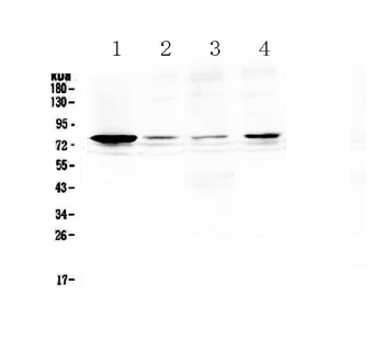 RANK/TNFRSF11A Rabbit Polyclonal Antibody