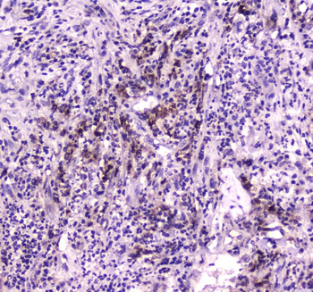 Niemann Pick C2/NPC2 Rabbit Polyclonal Antibody