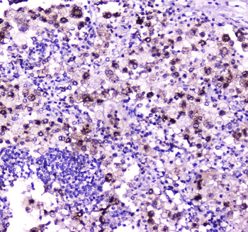 Niemann Pick C2/NPC2 Rabbit Polyclonal Antibody