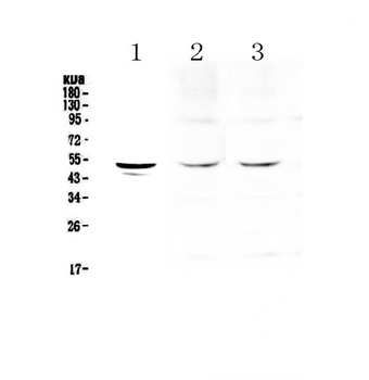 Tryptophan Hydroxylase/TPH1 Rabbit Polyclonal Antibody