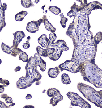 RAB6A Rabbit Polyclonal Antibody