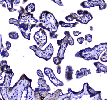 LGALS3BP Rabbit Polyclonal Antibody