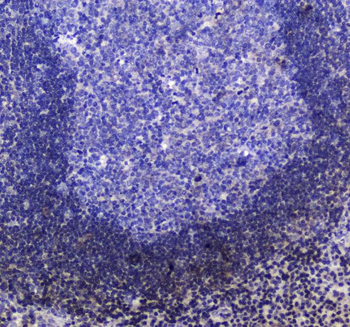 SHIP/INPP5D Rabbit Polyclonal Antibody