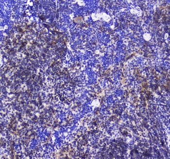 SHIP/INPP5D Rabbit Polyclonal Antibody