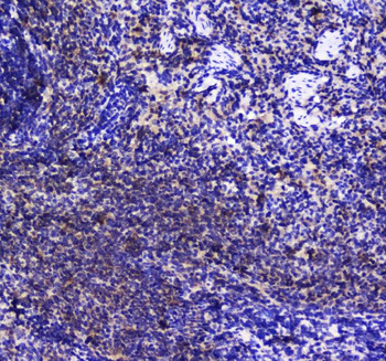 SHIP/INPP5D Rabbit Polyclonal Antibody