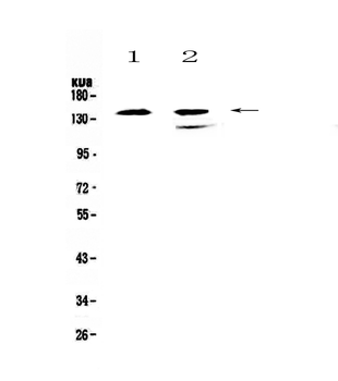 SHIP/INPP5D Rabbit Polyclonal Antibody