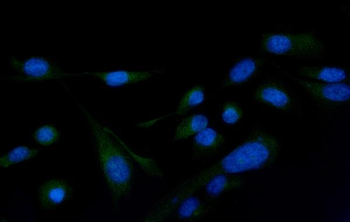 PLCG 2/PLCG2 Rabbit Polyclonal Antibody