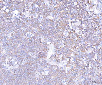 PLCG 2/PLCG2 Rabbit Polyclonal Antibody