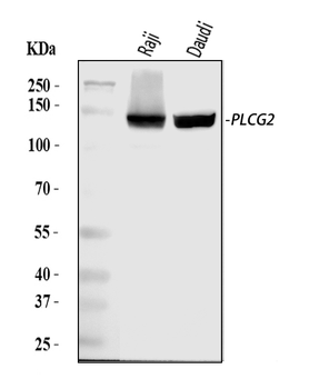 PLCG 2/PLCG2 Rabbit Polyclonal Antibody