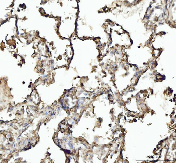 Annexin VI/ANXA6 Rabbit Polyclonal Antibody
