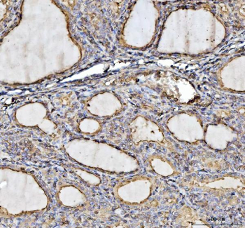 Annexin VI/ANXA6 Rabbit Polyclonal Antibody