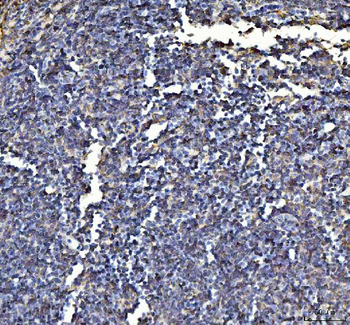 Annexin VI/ANXA6 Rabbit Polyclonal Antibody