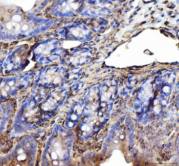 Annexin VI/ANXA6 Rabbit Polyclonal Antibody