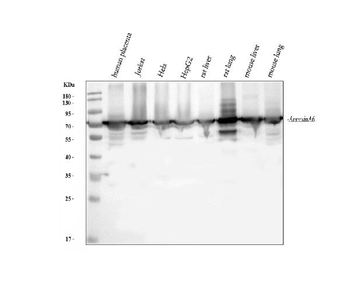 Annexin VI/ANXA6 Rabbit Polyclonal Antibody